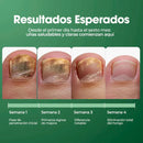 ¡TERBINAFINA!: El aceite que elimina los hongos de tus uñas - Neutraliza el mal olor y repara la piel. Fórmula vegana, segura y de uso diario