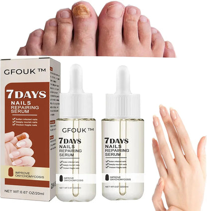 Nails Repairing - Suero Reparador de Uñas