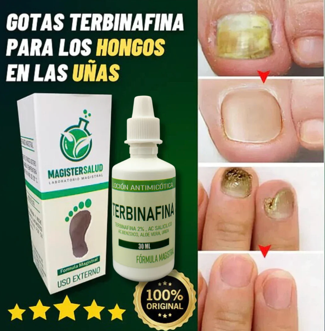 ¡TERBINAFINA!: El aceite que elimina los hongos de tus uñas - Neutraliza el mal olor y repara la piel. Fórmula vegana, segura y de uso diario