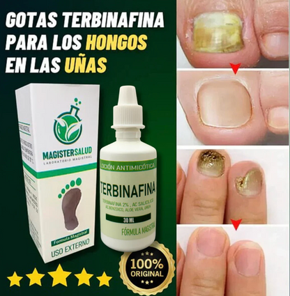 ¡TERBINAFINA!: El aceite que elimina los hongos de tus uñas - Neutraliza el mal olor y repara la piel. Fórmula vegana, segura y de uso diario