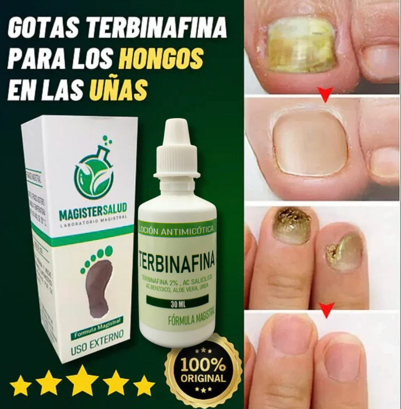 ¡TERBINAFINA!: El aceite que elimina los hongos de tus uñas - Neutraliza el mal olor y repara la piel. Fórmula vegana, segura y de uso diario
