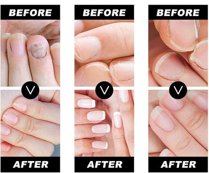 Nails Repairing - Suero Reparador de Uñas