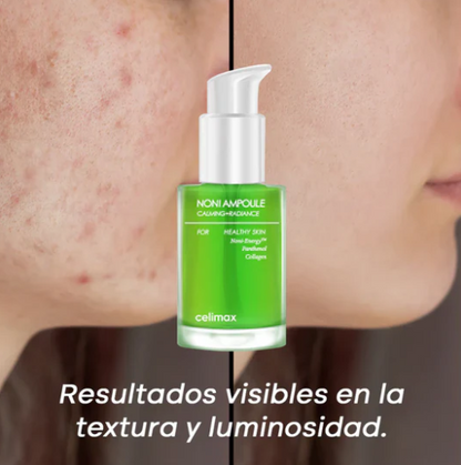 SERUM DE NONI COREANO - PREVIENE ARRUGAS Y AYUDA A CALMAR EL ACNÉ